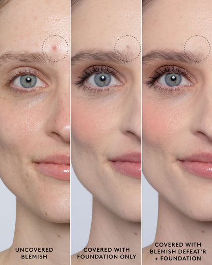 Close-up of model's light-toned face showing an uncovered blemish, a foundation-covered blemish and a foundation and Blemish Defeat'r BHA Spot-Targeting Gel-covered blemish.